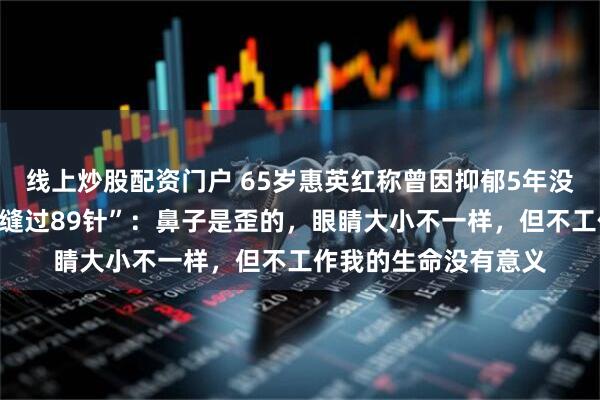 线上炒股配资门户 65岁惠英红称曾因抑郁5年没法出门，回应“脸上缝过89针”：鼻子是歪的，眼睛大小不一样，但不工作我的生命没有意义